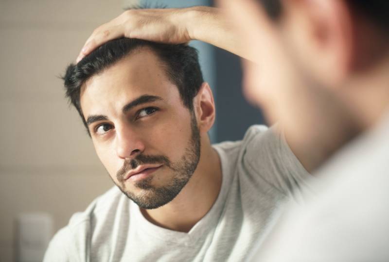 la micro greffe de cheveux ou implants capillaire avec la meilleure  technique prelevement  FUE a Marseille