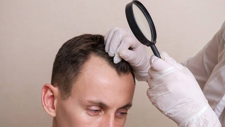 La biotine dans le traitement des cheveux au centre de soin et d'implant capillaire St-ic à Marseille
