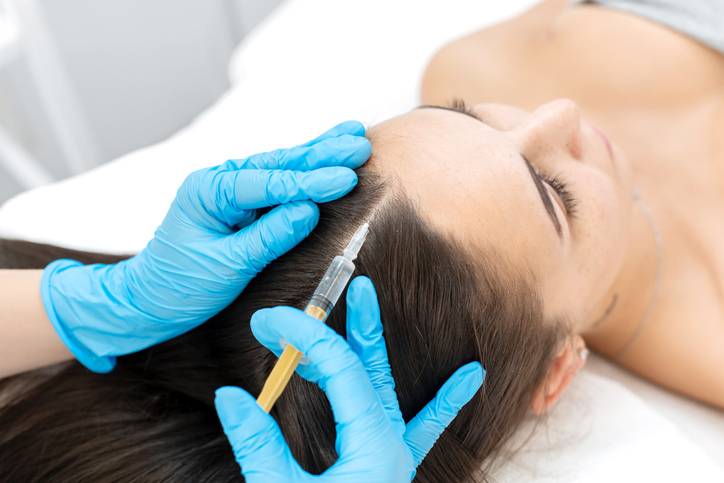 Quel est l'intérêt de la mésothérapie en matière de chute des cheveux ?